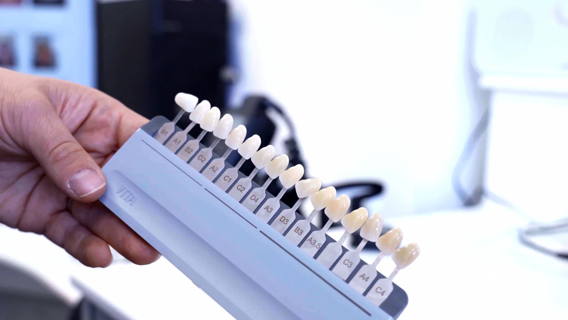 Dental shade guide used during treatment at Genix Healthcare