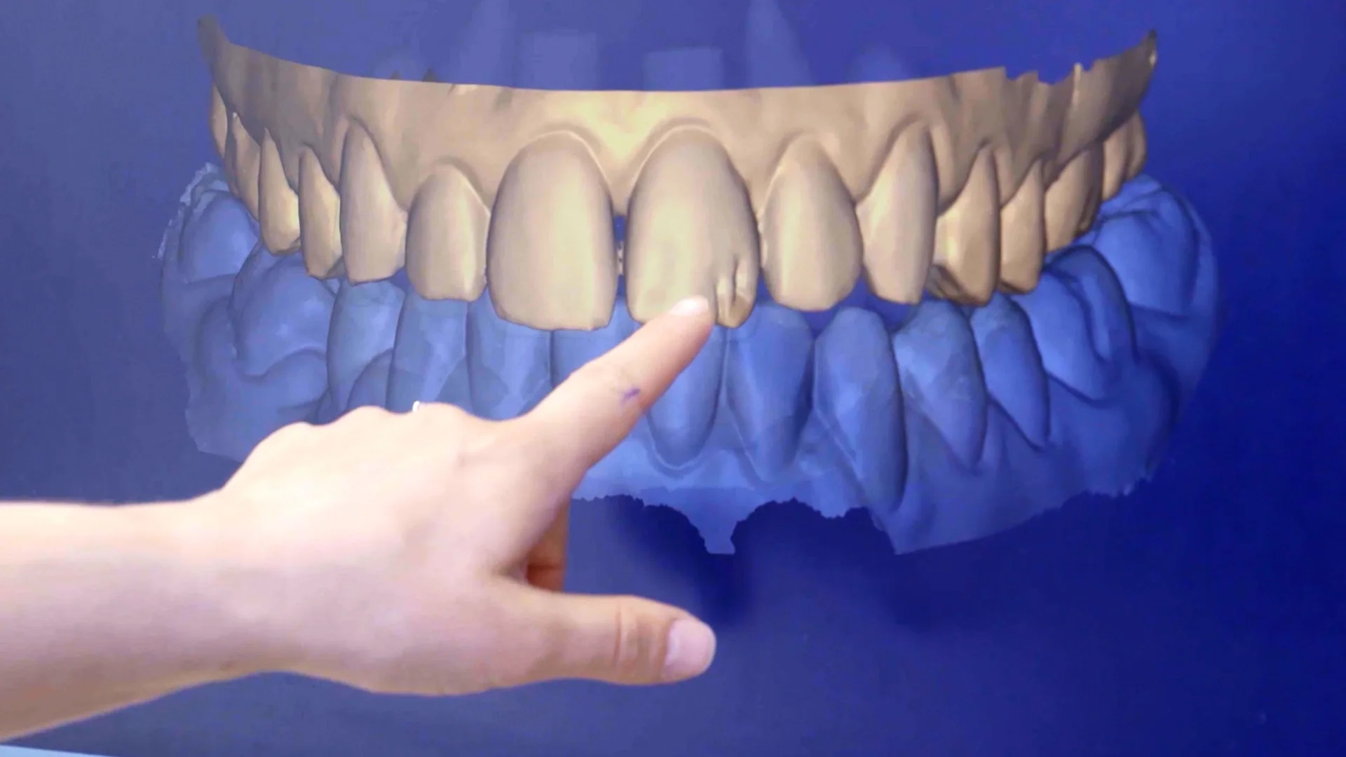 Digital dental scan displayed during Genix Healthcare treatment